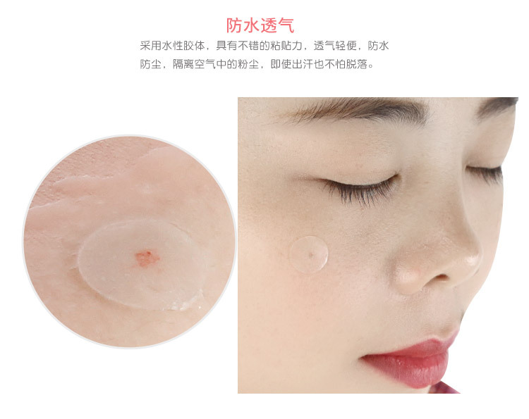 痘痘贴水胶体痘痘贴隐形祛痘贴oem遮痘贴