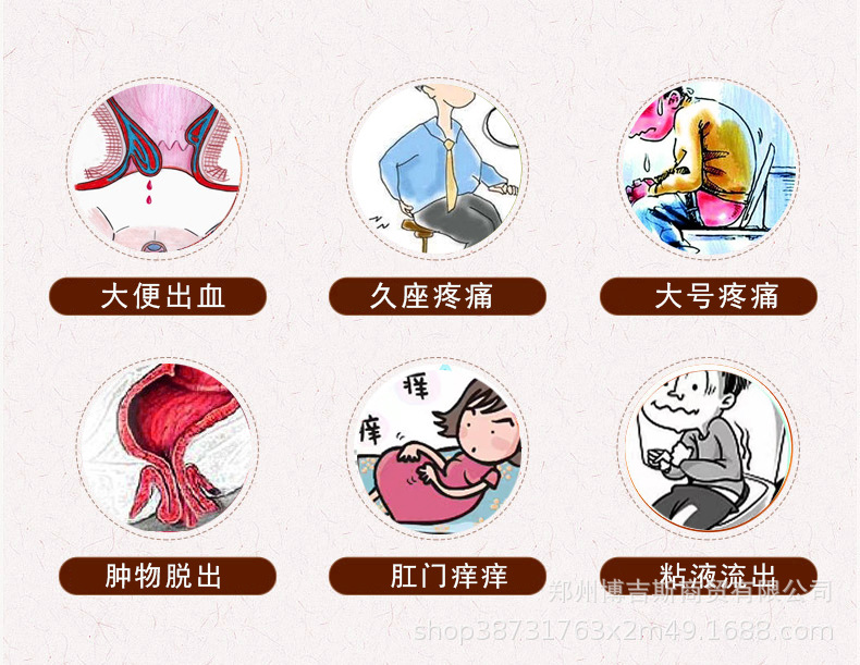 痔疮膏 痔康凝胶十八味草本消痔散结断痔膏消肉球内外混合肛痒舒