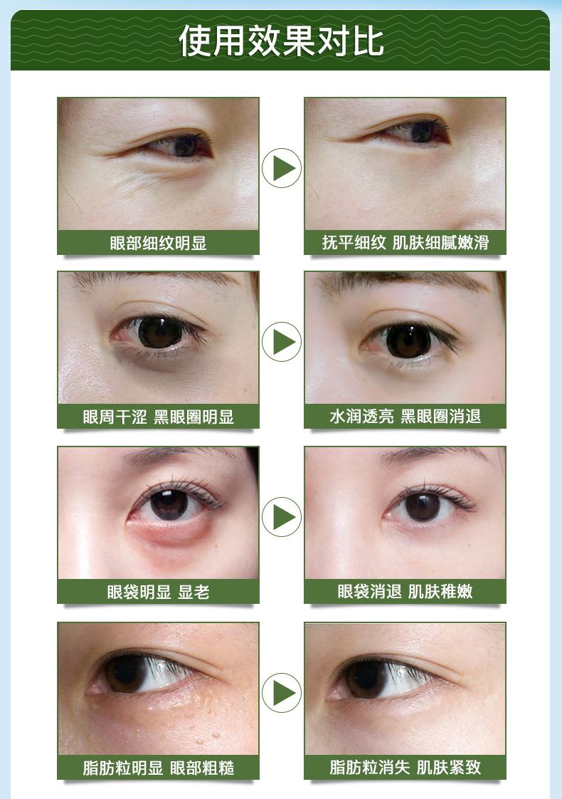 【7天去除黑眼圈】去眼袋/去脂肪粒/细纹干纹鱼尾纹/美目精油10ml