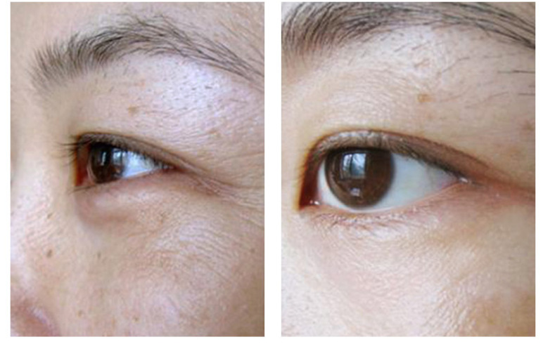 五维滚珠头类蛇毒眼霜熬夜党去黑眼圈紧致细纹去脂肪粒类蛇毒眼霜