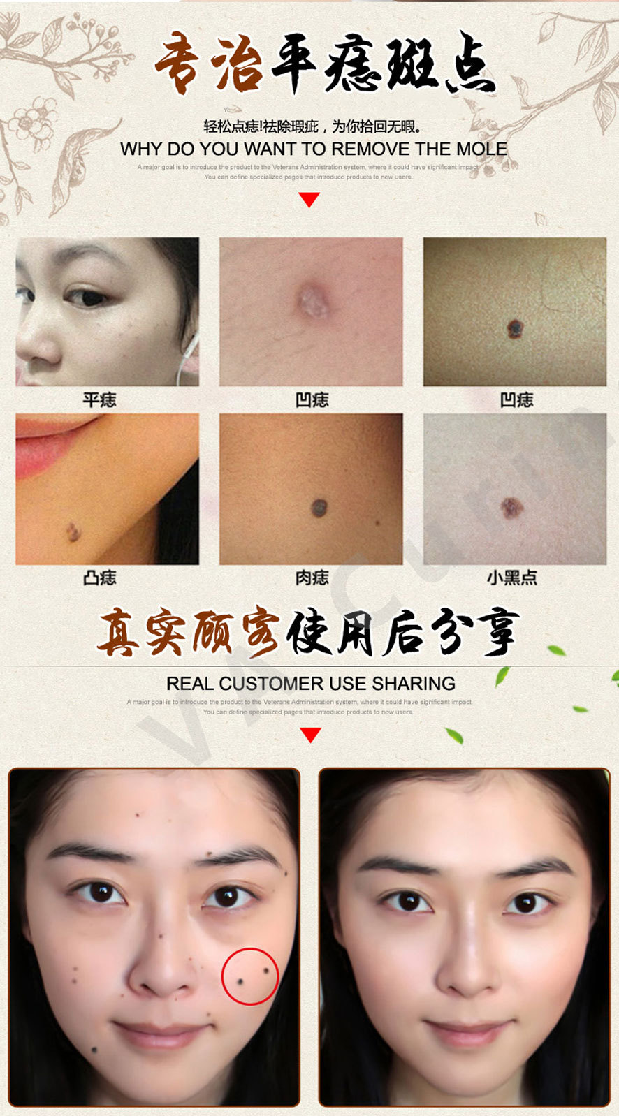无痛水痦子黑痣斑点瘊子老年斑美容金水化妆品oem厂家
