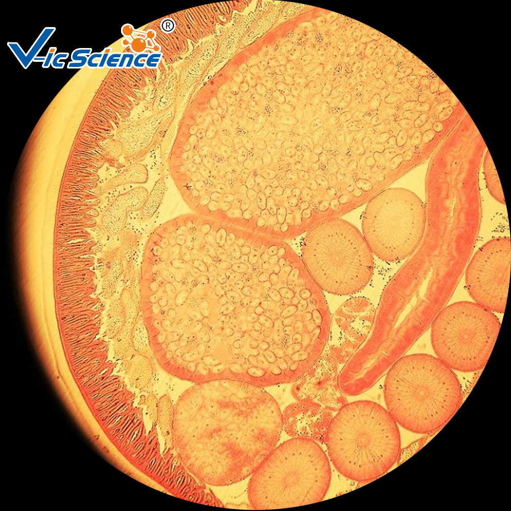 雄蛔虫横切1 副本