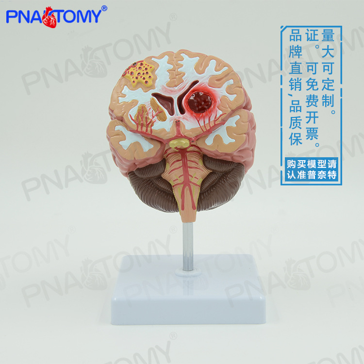 大脑基地核脑室铸型丘脑中枢神经杏仁核放大解剖模型脑科标本