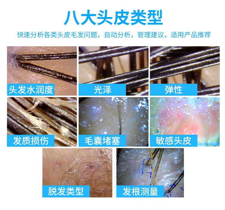 厂家批发高清智能头发头皮检测仪毛发毛囊分析测试一体机仪器