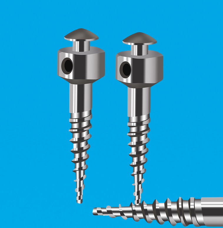 专业代工骨钉 种植钉