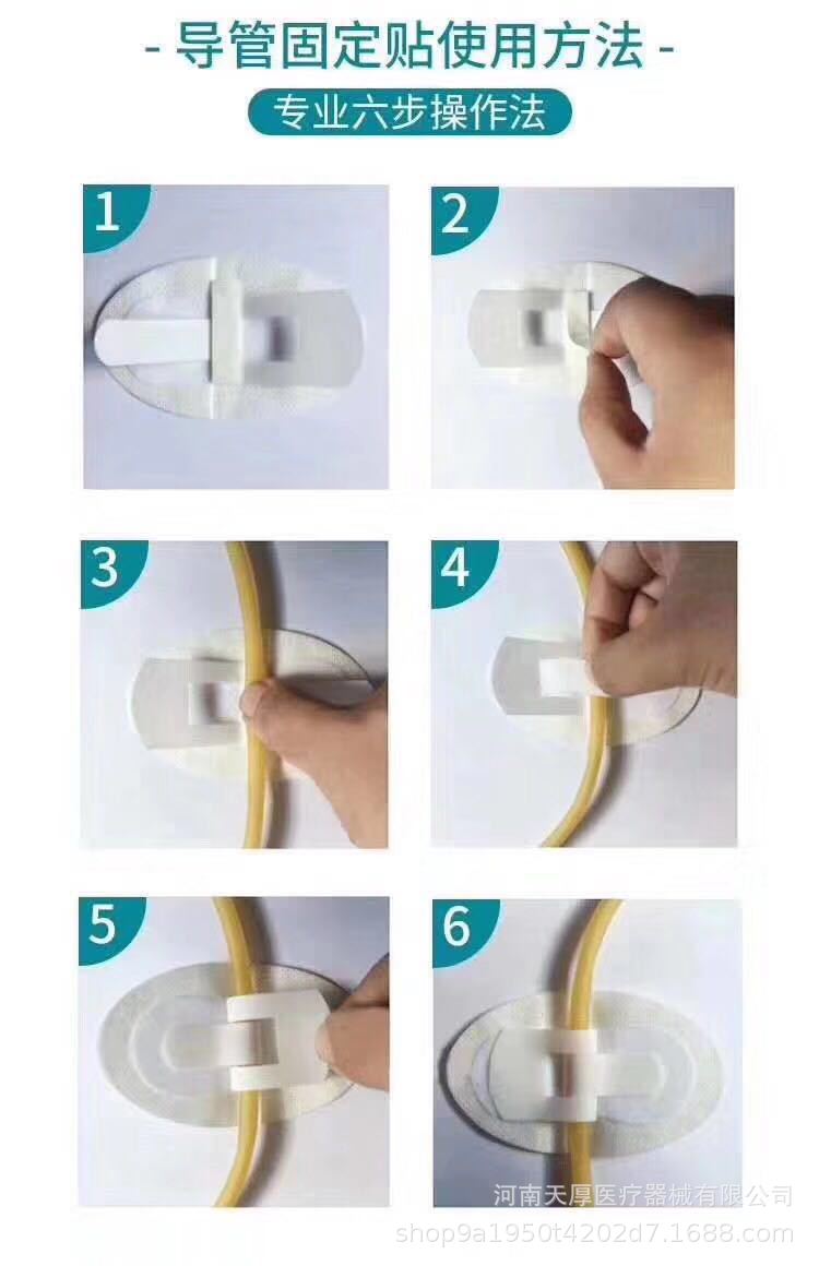 海壳生导尿管贴宏康引流管固定贴20片/盒504海纯导管固定器