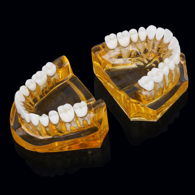 口腔教学模型下两半透明树脂水晶黄色牙模标准型成人牙模可拆卸上