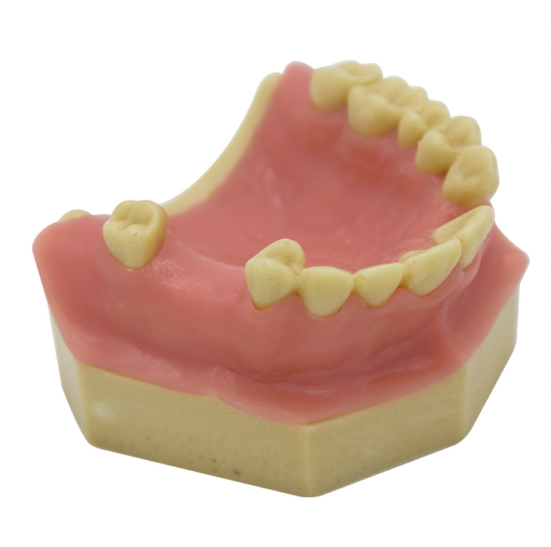 牙科材料牙齿模型口腔种植练习软牙龈上颔缺失牙种植i款fm-d022