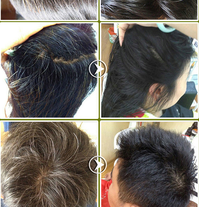 何首乌中草药洗发水少年白发转乌发中老年植物变黑发男女士养发