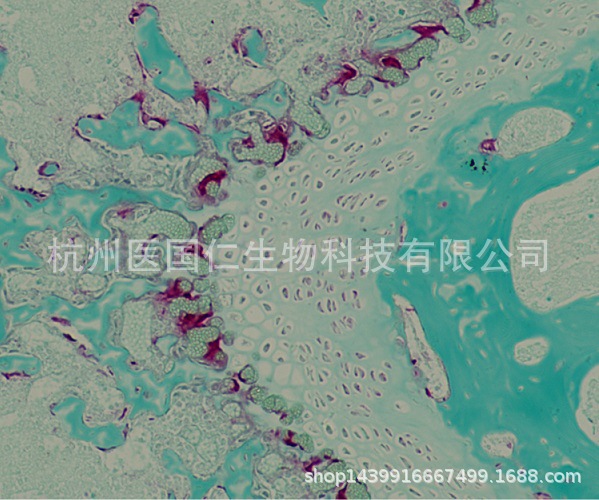 trap染色 组织样本病理技术服务