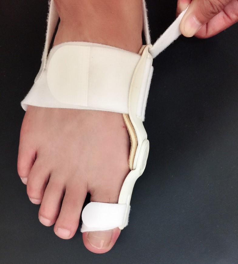 源头厂家拇指外翻固定矫形器 大脚骨拇外翻矫正器