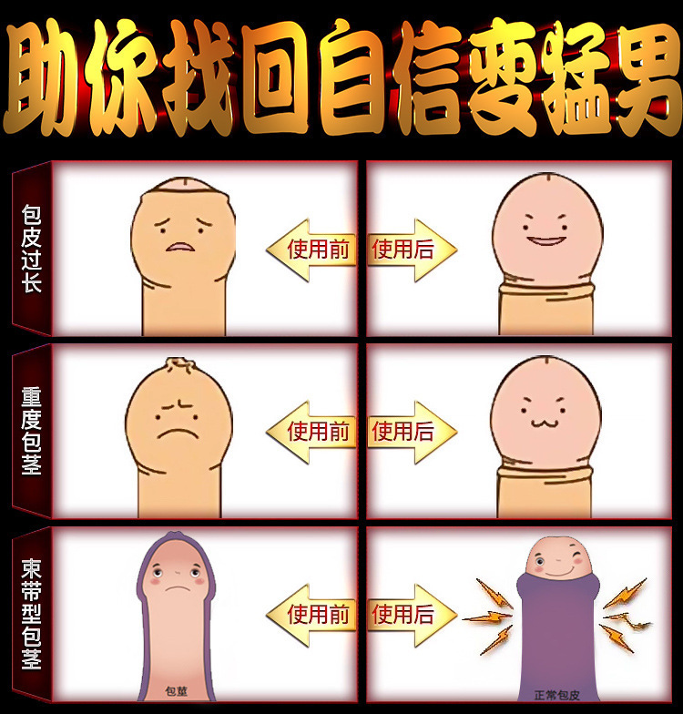 独爱包皮凝胶男性物理包皮阻复矫正精华液男用保健成人用品代发