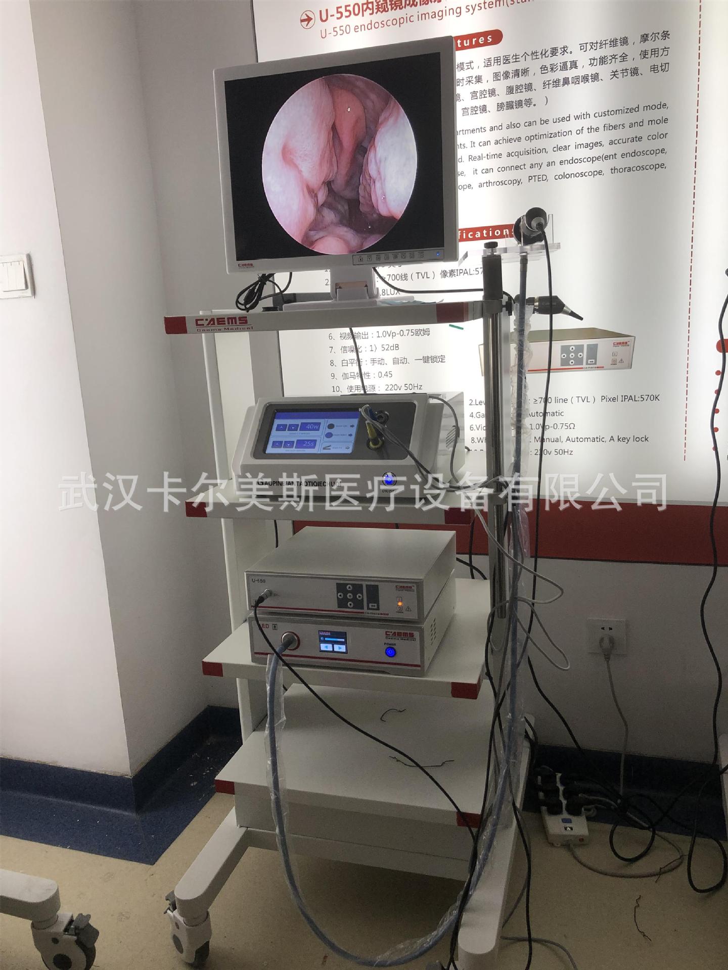 鼻内镜系统耳鼻喉内窥镜影像工作站高清鼻腔镜耳鼻喉内窥镜