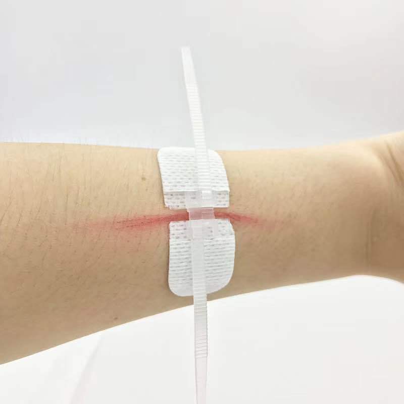 源头工厂新品拉链式伤口缝合贴 无创无针线免缝贴 新型创可贴