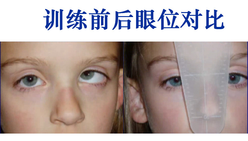 儿童内斜训练矫正遮挡板斜视训练双鼻侧遮盖板黑白矫正板