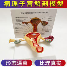 人体女性生殖子宫解剖病理模型 阴道卵巢教学模型 妇科生殖科教具