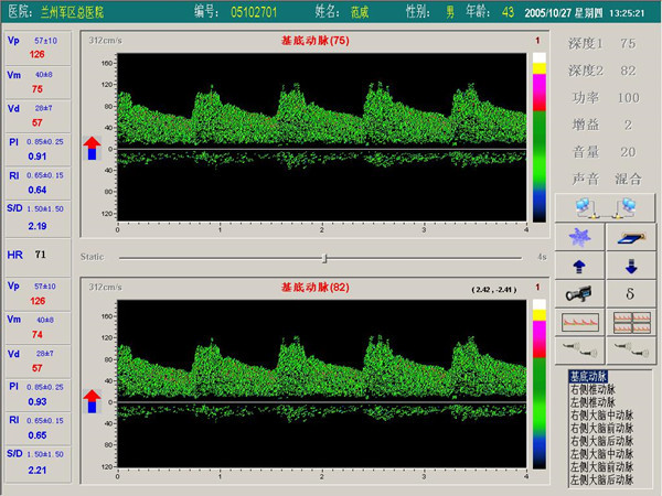 告诉你经颅多普勒血流分析仪双通道和双深度的检测界面