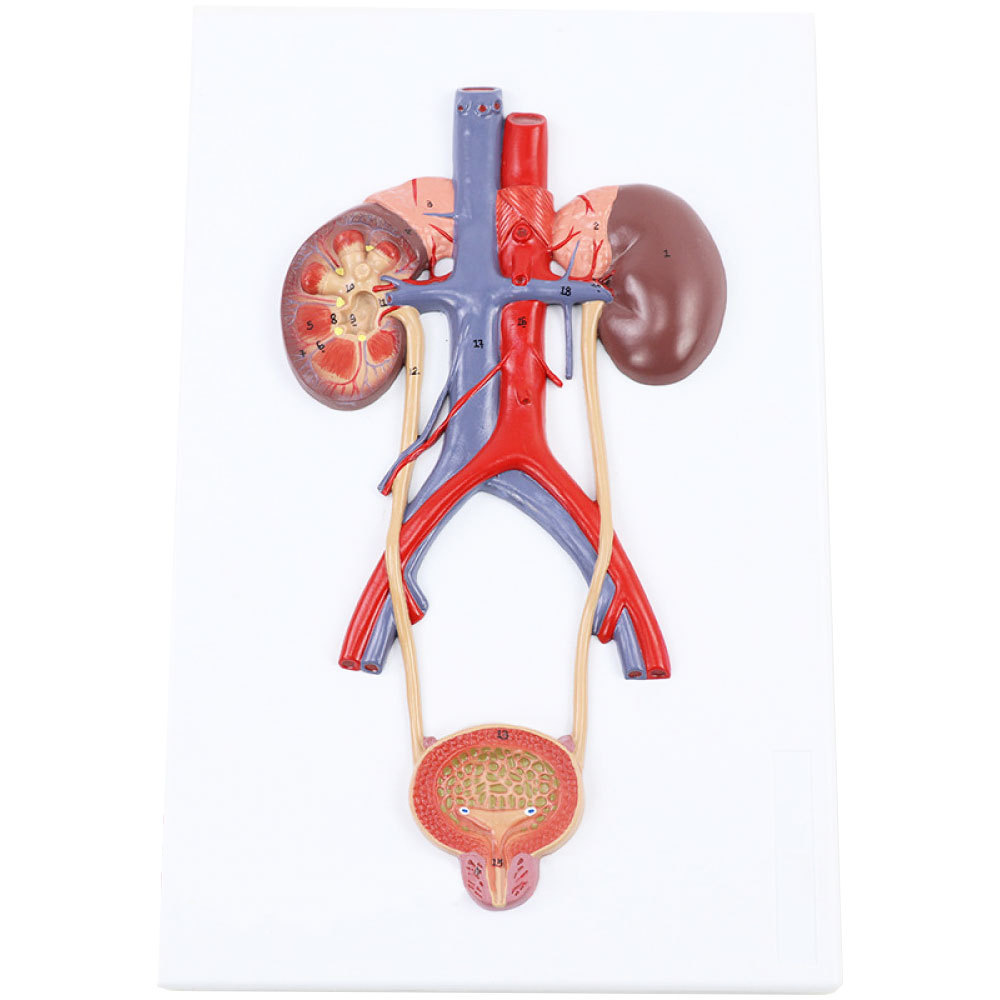 人体泌尿系统模型输尿管膀胱尿道模型肾解剖模型医学泌尿系统外科