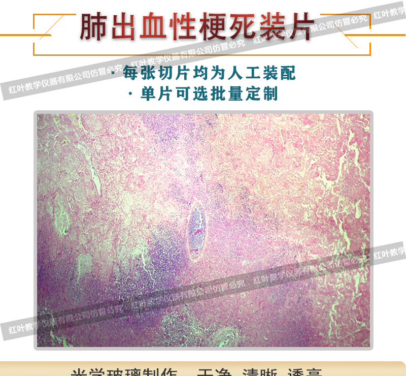 肺出血性梗死生物切片病理切片显微镜配套生物切片