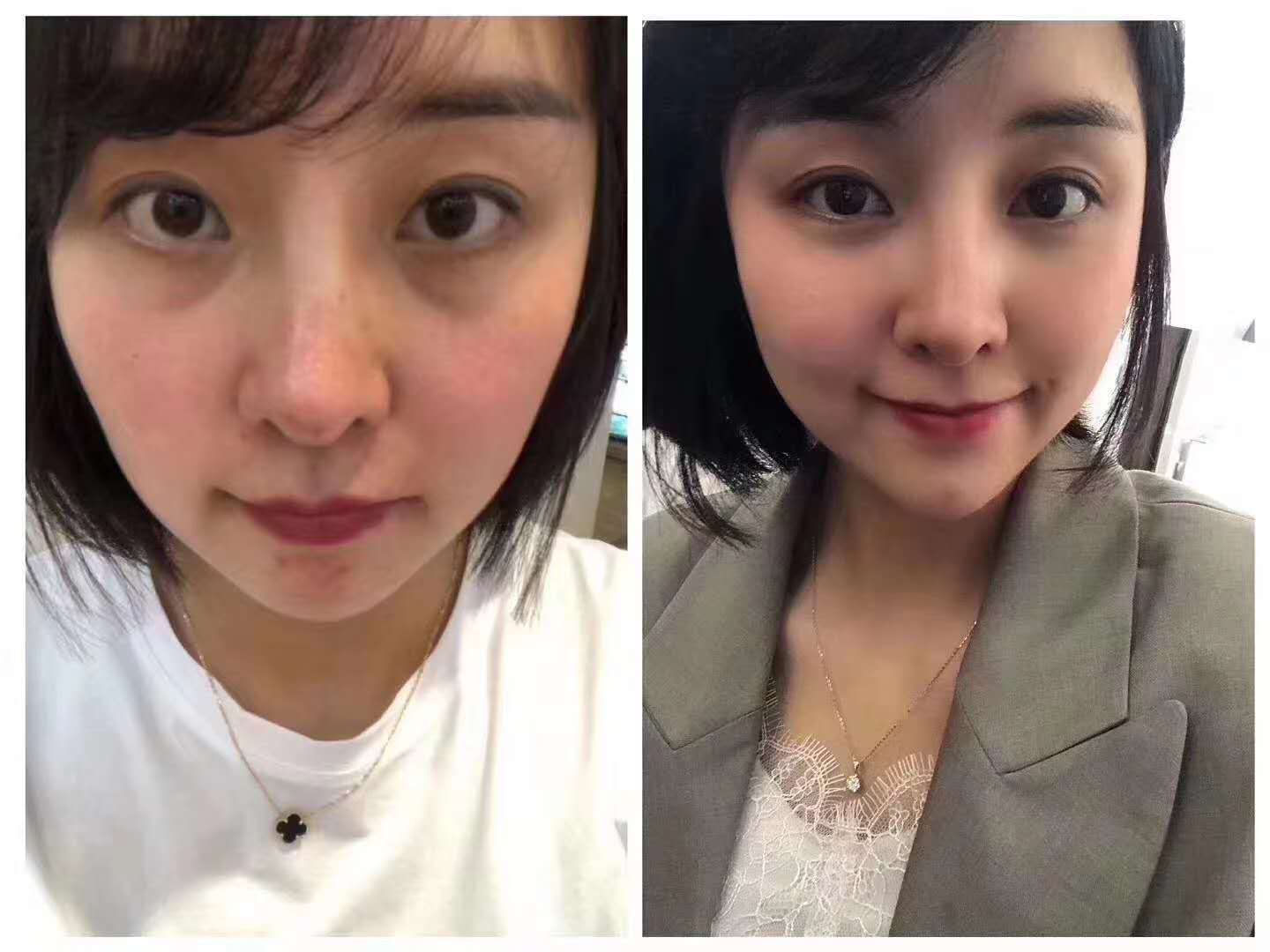 暨大深导干细胞填充冻干粉深导全脸塑型促进生长高活性肽源头工厂