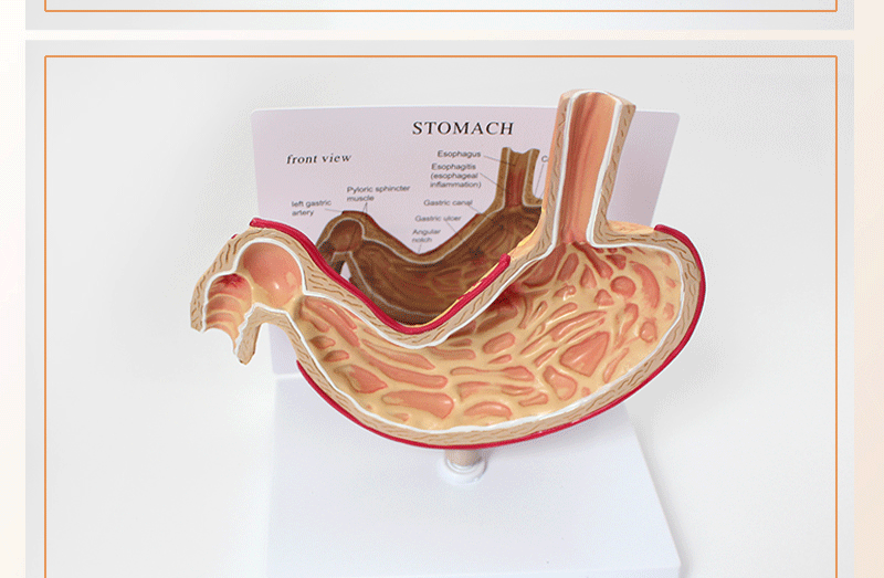 胃模型