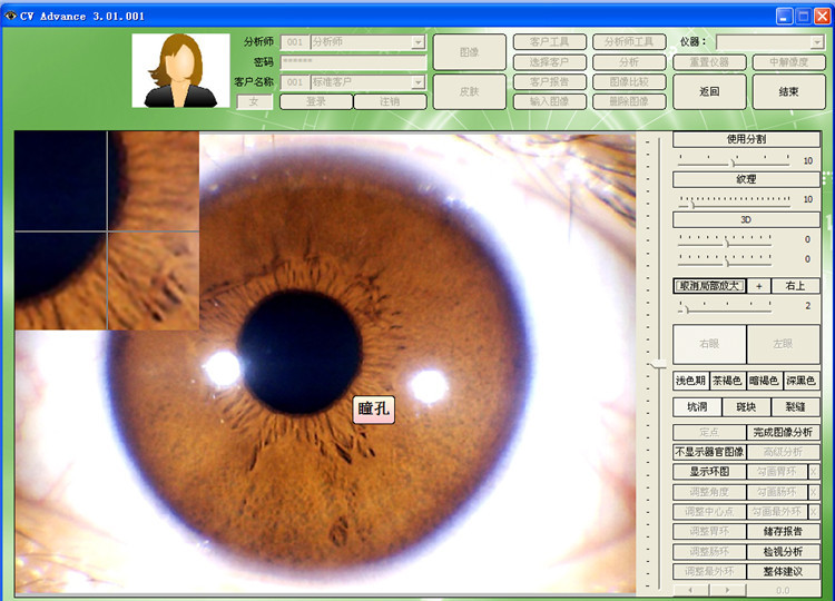 500万像高清素虹膜分析检测 电脑型usb自动虹膜检测仪