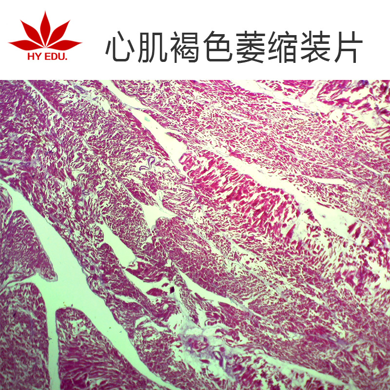 心肌褐色萎缩生物切片人体病理切片显微镜配套生物切片