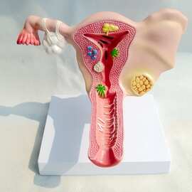 医学女性子宫模型卵巢生殖结构解剖模型妇科妇产科卵巢子宫模型