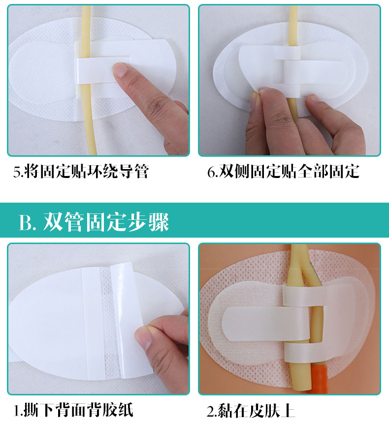 批发直供-医用picc体表导管粘贴固定装置导尿管引流管导管鼻饲贴