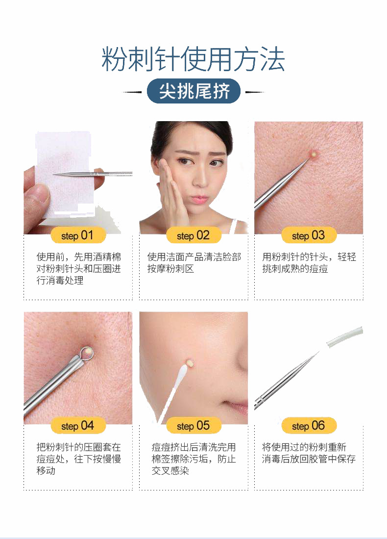 厂家直销粉刺针4件套不锈钢挑痘痘针挤脂肪粒黑头工具现货批发