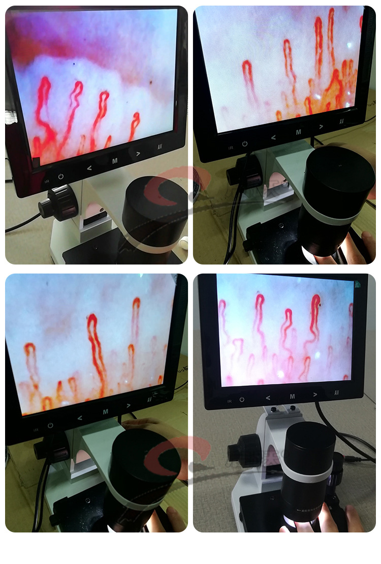 广州启跃 qy880高清微型循环检测仪末梢血管观察仪便携式显微镜