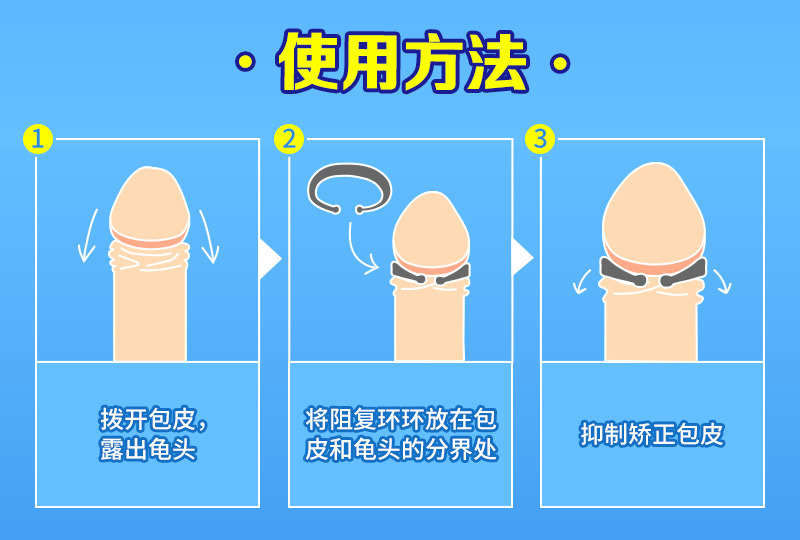 译爱包皮阻复环男用c型环外用成人情趣性用品批发一件代发