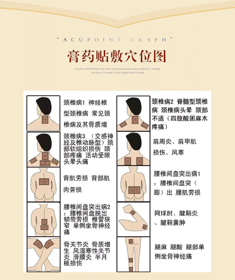 源自越南黑膏药贴周炎滑膜炎腰肌劳损骨质增生贴腰椎间盘突出贴膏