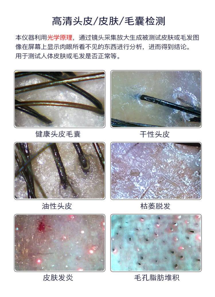 八核四光谱头高清头皮检测仪带屏一体机检测仪毛囊头发皮肤检测仪