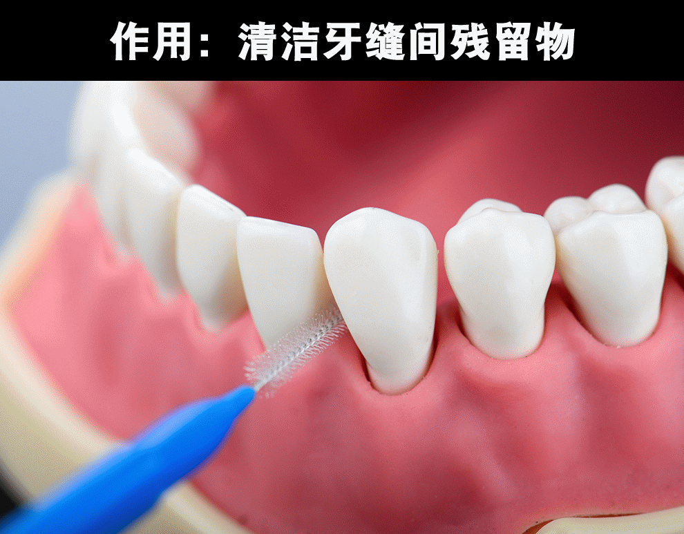 cleanpik直型牙缝刷齿间刷 正畸牙刷不绣钢丝40支/盒包邮