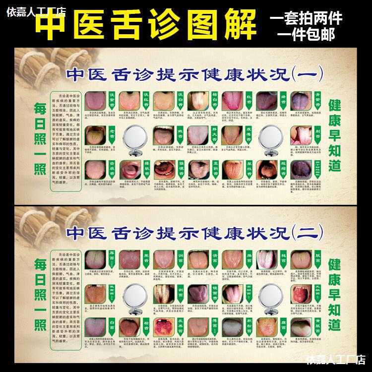 中医舌诊完全图解图谱美容院海报挂图养生图片宣传墙画装饰广告