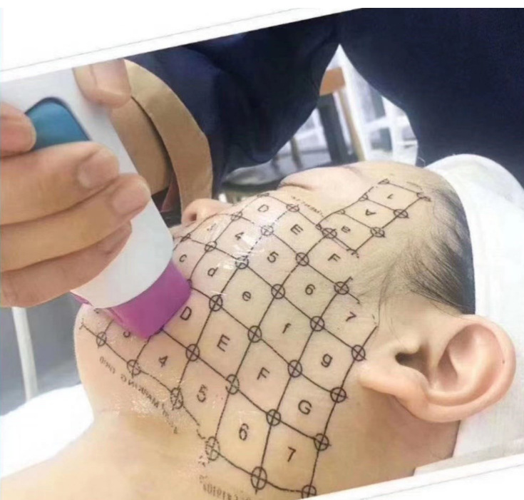 热玛吉打格纸热玛吉打格子热玛吉