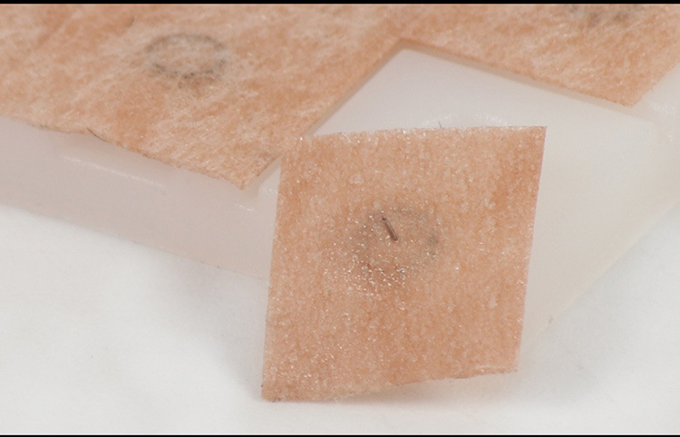 环球揿针耳贴针一次性钦针耳针皮内针嵌针100支带胶布