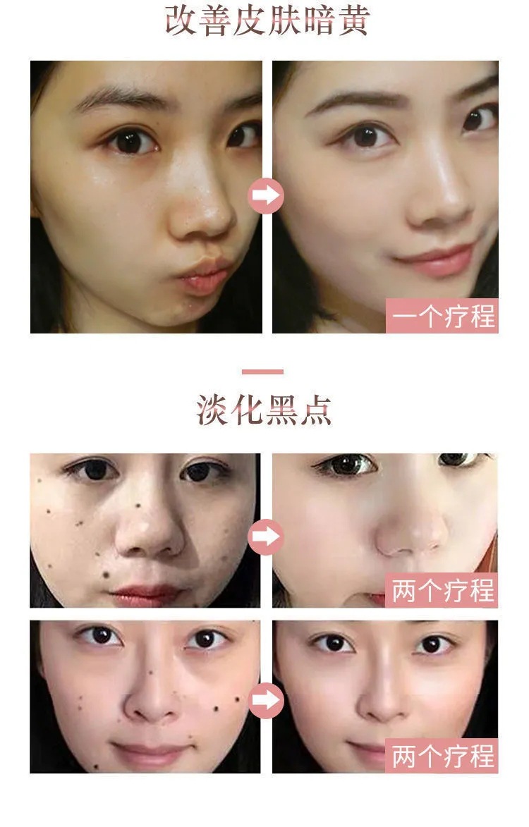 芊语蔲玫瑰精油药水淡化痣修复面部肌肤祛黑点色素男女士一件代发