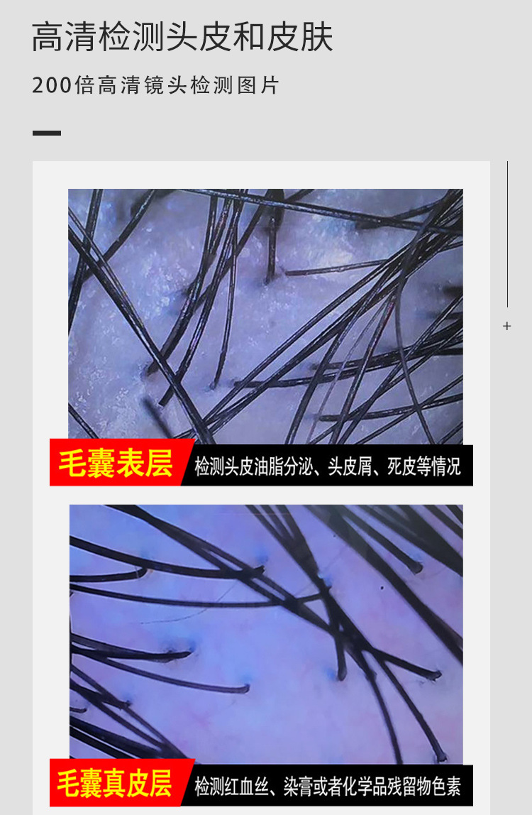工厂直销台式头皮检测仪理发店毛囊高清一体机头疗仪毛发头部检测