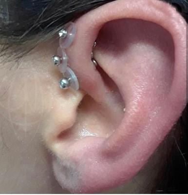 防增生内陷消除息肉小飞碟医用硅胶固定圈唇钉耳钉穿刺穿孔配件