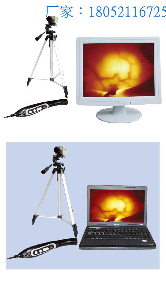 佳华jh7005双屏双探头红外乳腺诊断仪国产乳腺检查仪