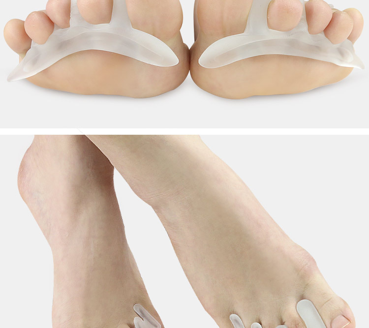 脚夹拇趾外翻分趾大脚骨重叠脚指校正脚趾 脚趾矫正 矫正鞋垫