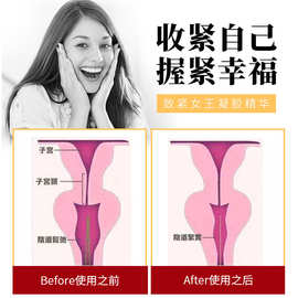 女性阴道护理液