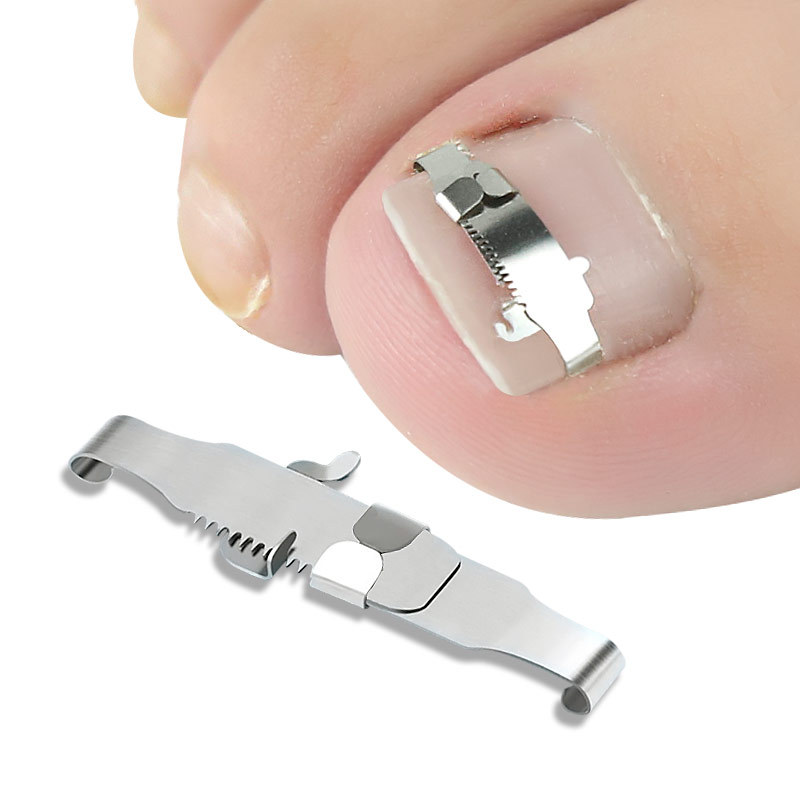 nail buckle toenail straightening sticker nail groove onyxis corrector toenail knife embedded gray nail suit nail braces