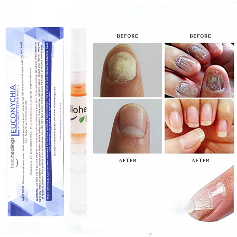 crazylife plant nail care solution 灰指甲 指甲护理笔 3ml