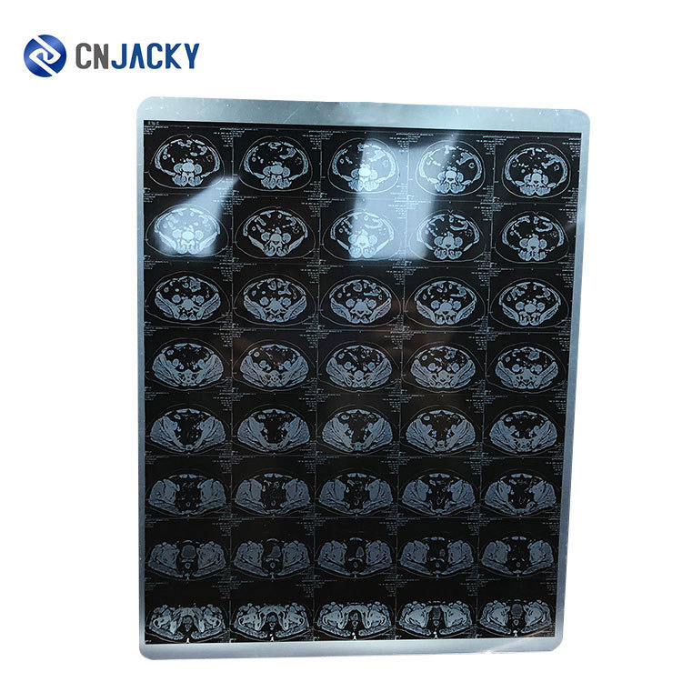 8*10蓝色医用胶片 pvc放射科胶片a4彩超ct胶片纸激光蓝基医疗胶片