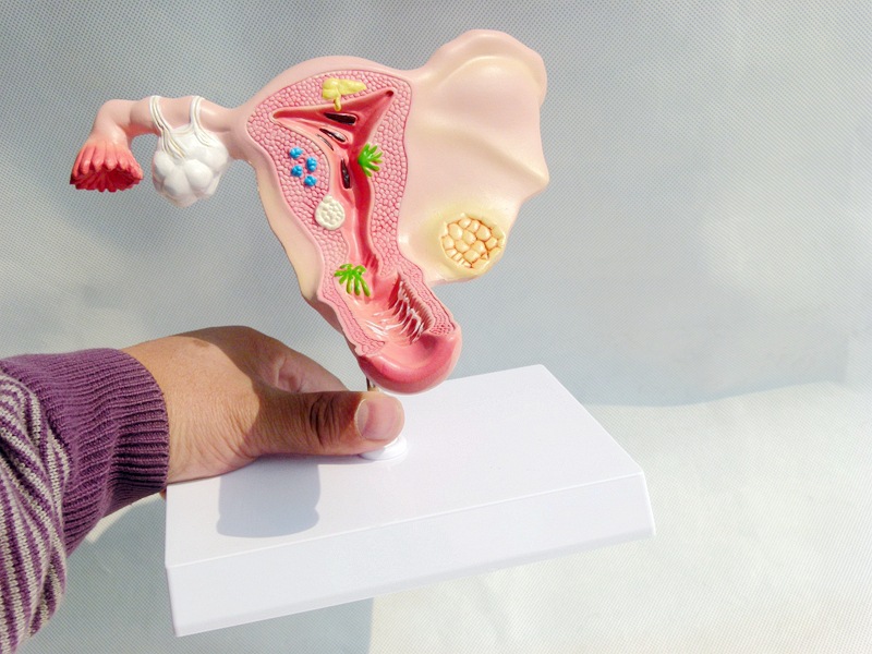 医学女性子宫模型卵巢生殖结构解剖模型妇科妇产科卵巢子宫模型