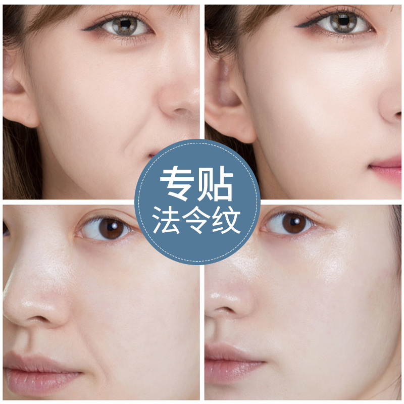 熙格抗老提拉紧致淡化嘴角细纹八字纹网红淡表情纹微晶法令纹贴