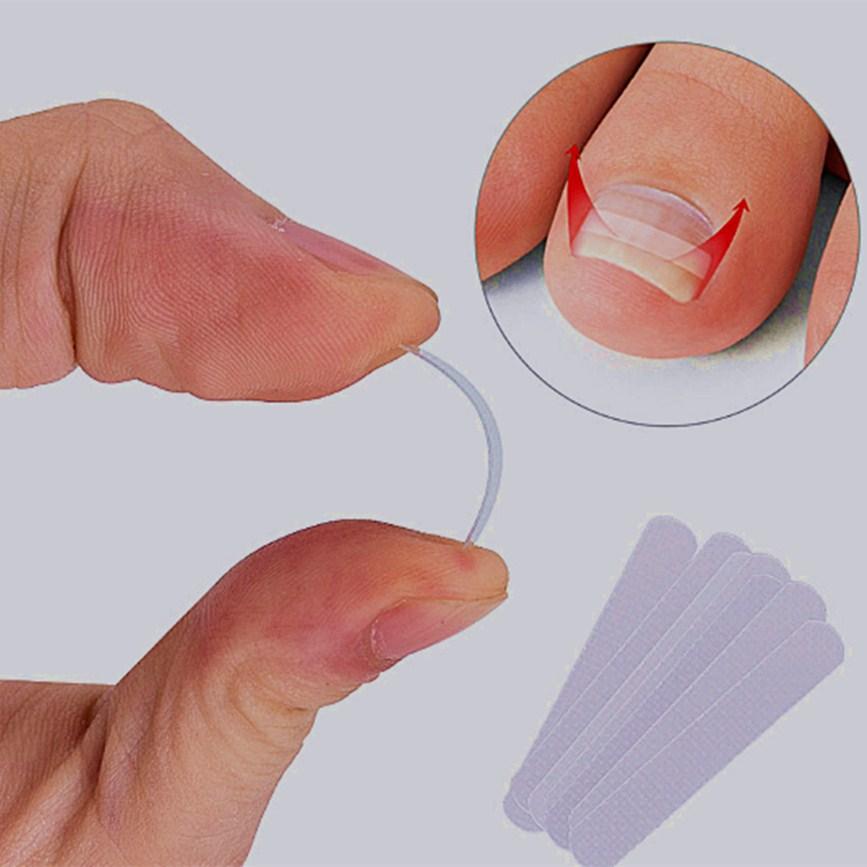 厂家批发正甲贴 嵌甲矫正贴片拉拉贴反拉力嵌甲贴片